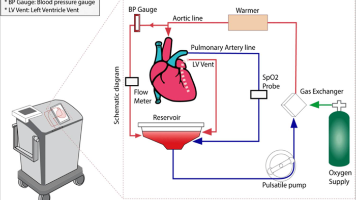 cardian transplant graphic