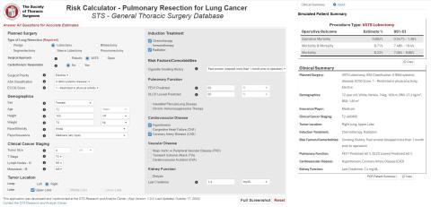 lung cancer